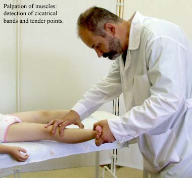Palpation of muscles: detection of cicatrical bands and tender points.