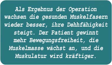 Als Ergebnis der Operation wachsen die gesunden Muskelfasern wieder besser, ihre Dehnfähigkeit steigt. Der Patient gewinnt mehr Bewegungsfreiheit, die Muskelmasse wächst an, und die Muskulatur wird kräftiger.